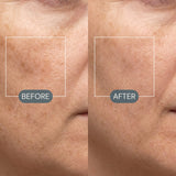 DualLight® Laser + LED Light Therapy Face Mask view 14