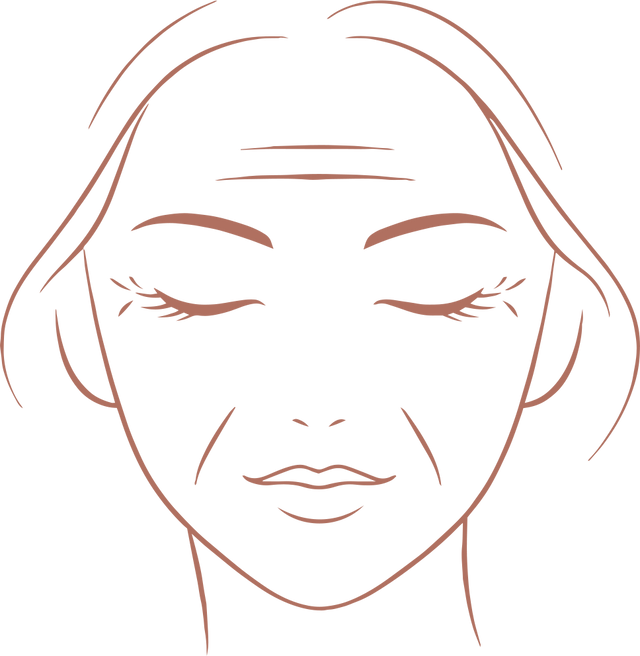 Fine lines & deep wrinkles