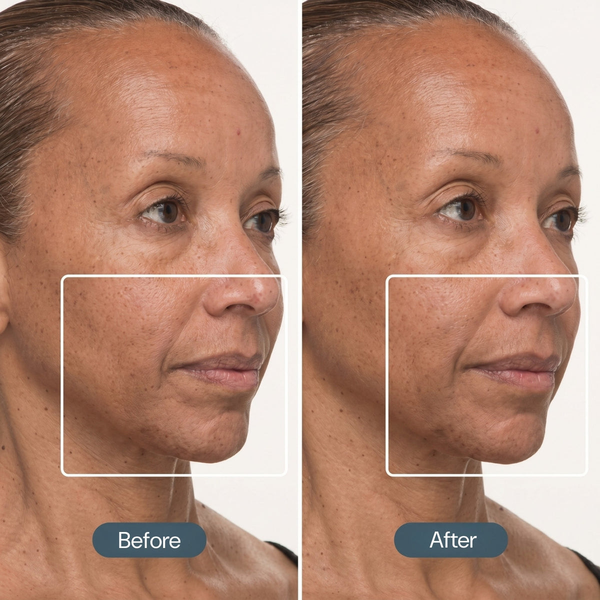 Before and after comparison of a woman's face with visible skin texture differences.