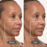 Before and after comparison of a woman's face with visible skin texture differences.
