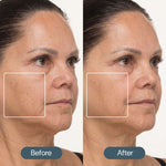 Before and after comparison of a woman's face with visible skin texture differences.
