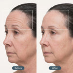 Before and after comparison of a woman's face with visible skin texture and lines.