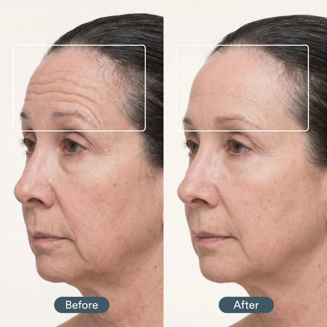 Before and after comparison of a woman's face with visible skin texture and lines.