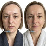 DualLight® Laser + LED Light Therapy Face Mask view 7