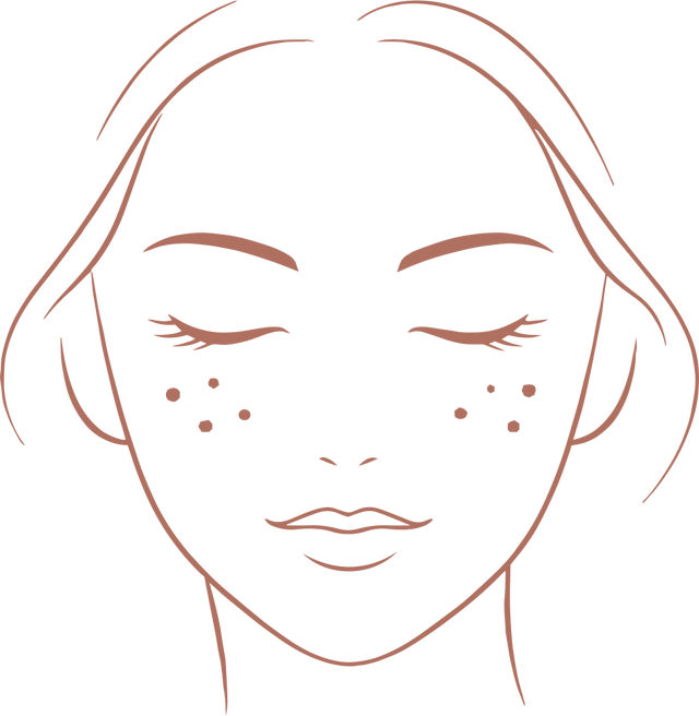 Occasional breakouts